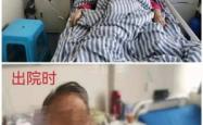 赤峰市白血病医院电话号码