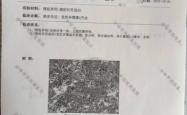 赤峰惠康医体检中心电话号码