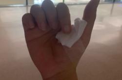 赤峰治疗腱鞘炎电话是多少号