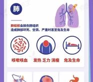 赤峰肺瘤医院地址电话查询号码