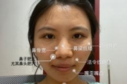 赤峰美容达人名单电话是多少号