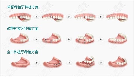 赤峰瑞美口腔医院电话地址查询-第1张图片