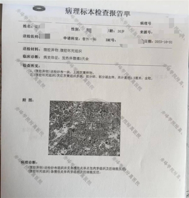 赤峰惠康医体检中心电话号码-第1张图片