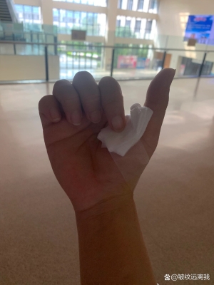 赤峰治疗腱鞘炎电话是多少号-第1张图片