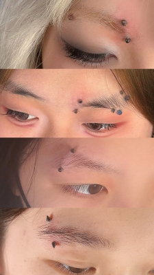 赤峰眉钉穿孔医院电话是多少号-第1张图片